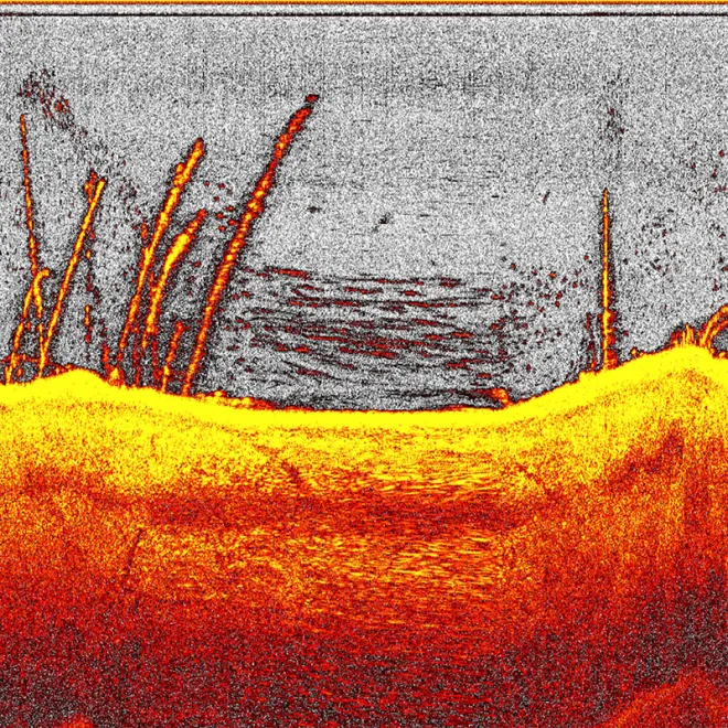 Deeper Futterboot Quest mit Downscan-Modul Undervision